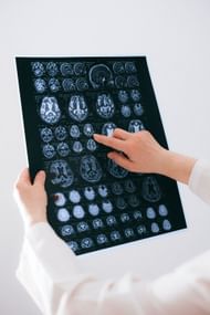 Common triggers of seizures (Image via Pexels)